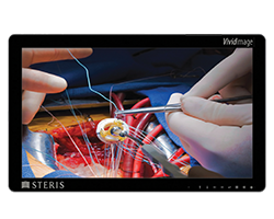 Surgical displays